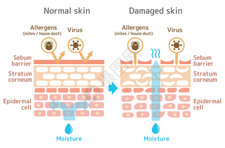 皮肤剖面图 健康皮肤与受伤皮肤保护效果对比图过敏药品器官解剖学横截面商业皮肤科卫生保健治疗背景图片