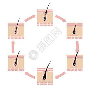 正常的头发周期它制作图案雄激素皮肤保健灯泡休止期化期插图真皮解剖学卵泡插画