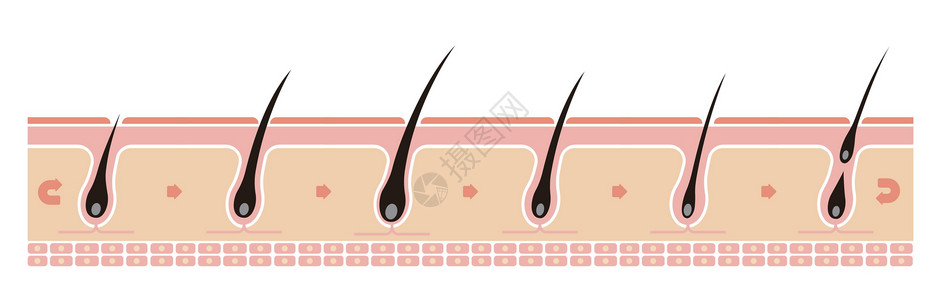 雄激素正常的头发周期它制作图案插图头皮乳突损失生长期灯泡解剖学化期药品真皮插画