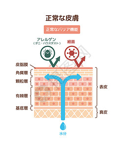 干燥皮肤正常皮肤矢量图的剖面图插图卫生护理瘙痒医生病人剥皮疾病过敏解剖学插画