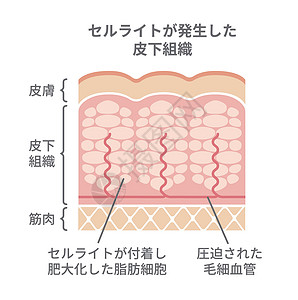 脂肪团皮肤它制作图案护理插图胶原治疗身体女士饮食卫生绘画生物学背景图片