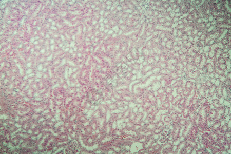 显微镜下的肾脏皮层 100x科学专用皮质老兵药品诊断胶囊康复考试肾小球背景图片