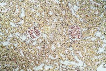 显微镜下的肾脏皮层 100x组织考试宏观单位医药康复科学诊断胶囊皮质背景图片