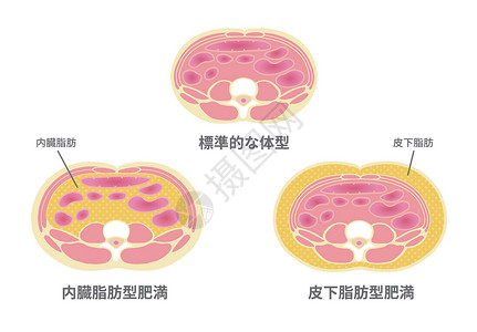 皮下脂肪身体肥胖的高清图片