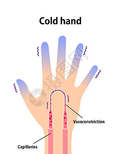 润手霜冷手血液循环图示对冷指尖的敏感性器官蓝色温度插图身体寒冷卡通片寒潮手指手臂设计图片
