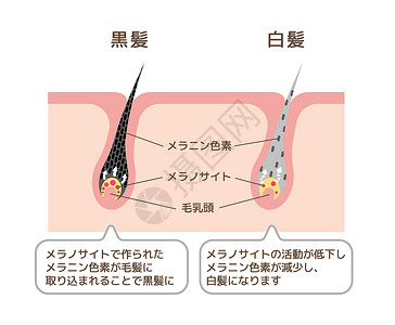 锦鲤来了有色头发和灰色头发比较矢量图日本的机制色素沉着祖父预防白发保健压力老化发色头皮成人插画