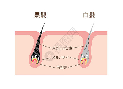 皮肤老化有色头发和灰色头发比较矢量图日本的机制老年祖父黑色素颜料头皮高龄保健插图治疗成人插画