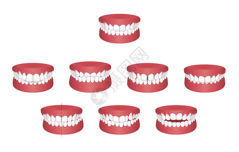 牙列拥挤牙齿麻烦咬类型矢量图 se假牙覆合插图牙列拔牙矫正双牙空腔疾病治疗插画