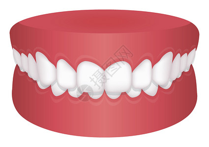 牙列拥挤牙齿问题咬合类型矢量图深钻插画