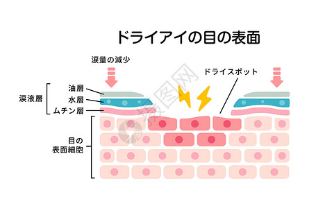 干眼表面的横截面 平面矢量图日本插画