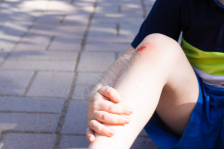 孩子腿上的伤口 倒在路上 膝盖骨折 健康 关于孩子跌倒的文章 关于伤口处理的文章 腿不好 孩子摔倒了 摔断了膝盖皮肤绷带免费女孩卫生保健高清图片素材