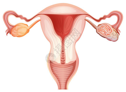 woma卵巢癌疾病艺术科学癌症生物学夹子绘画卡通片图表药品插画