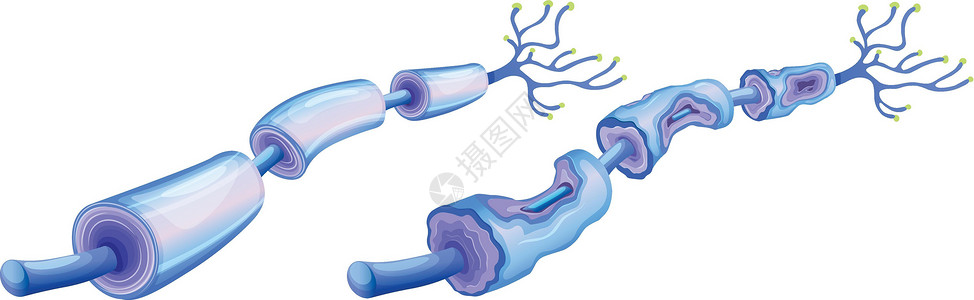 人类神经细胞和周围神经病变背景图片