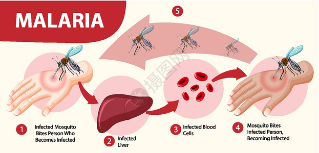 疟原虫疟疾症状信息图表标识插图漏洞全世界寄生虫呕吐病人框架横幅疾病插画