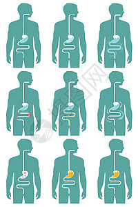 排肠毒消化系统消化排腹胀溃疡器官腹痛插图疾病疼痛胃炎冒号解剖学插画