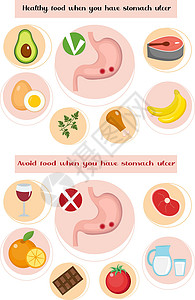 幽门螺杆菌患有胃溃疡病的人健康 避免进食; 预防胃疾病; 医学概念; 矢量图解设计图片