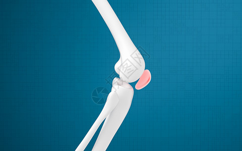 腿骨和膝盖损伤 3D感应外科生物学身体治疗关节渲染软骨疼痛骨科胫骨背景