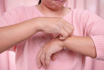 恼怒的中年妇女因皮肤干燥 湿疹 皮炎 过敏 牛皮癣而在手臂上抓痒 保健和皮肤病的概念发痒高清图片素材