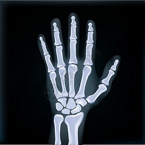 捷运现实的X射线手提医疗图象设计图片