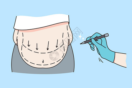 整形外科身体护理和抽脂概念设计图片