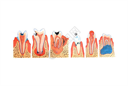 牙牙齿插图医生孩子牙科疾病健康成人口服医疗保健预防背景图片