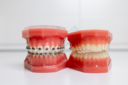 死神黑崎一护牙套在下巴牙牙上的口罩和牙齿模型微笑个人手套医生牙医外科护理技术手术口腔背景