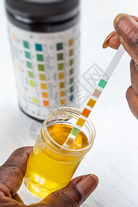 空腹尿液分析健康高清图片