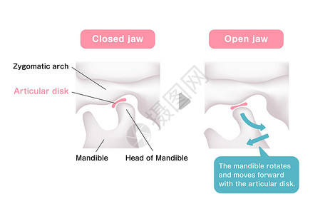 颞下颌关节开启和特写下巴时的结构插图Name身体牙齿骨头骨骼生物学解剖学机能关节外科矫正设计图片