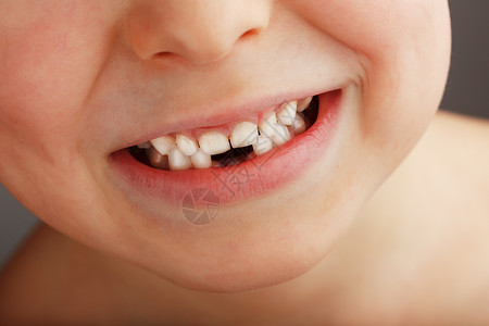 没有下乳牙的孩子的笑容 孩子笑容中的一个洞 有趣的概念青年牛奶疼痛牙膏女孩仙子冲洗童年生长衰变背景图片