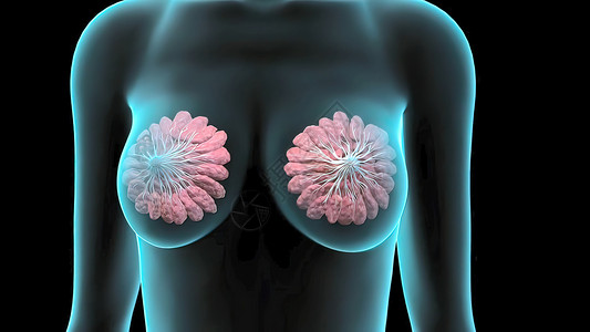雌性乳腺组织从锁骨延伸到臂窝和肋骨笼中央 掌声症状细胞女性胸部癌症诊断疾病传播化疗治疗背景图片