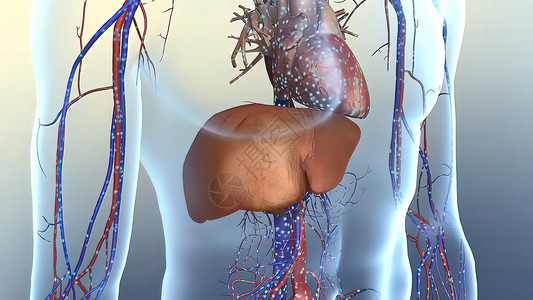数字化系统胆固醇是一种方法 在你的血液中发现类似脂肪的物质动脉硬化身体血管动脉血栓疾病肥胖形成药品宏观背景