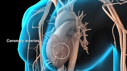 冠状动脉解剖学心血管危险肥胖医学饮食营养凝块动脉粥样硬化动脉细胞背景图片