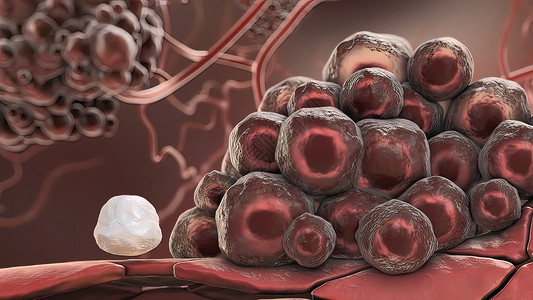 攻击白血细胞的癌症细胞疾病吞噬细胞防御感冒微生物学生活共轭预防生物学免疫背景图片