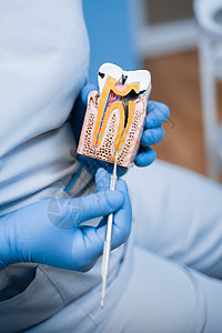 牙科医生展示了牙齿结构 牙的形状 这可真是一副有猫头鹰病态的假牙医生访问治愈技术矫正药品疼痛牙医卫生工具背景图片