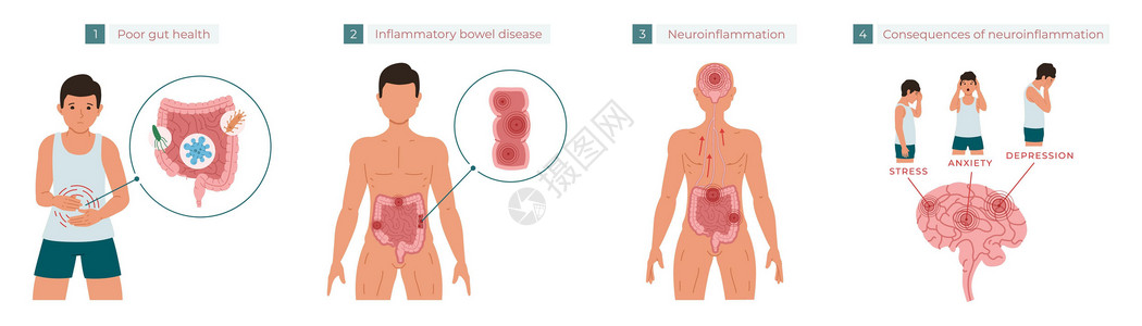 视力不佳肠道健康不佳会导致慢性炎症 进而导致神经炎症 从而导致压力 焦虑和抑郁 矢量图设计图片