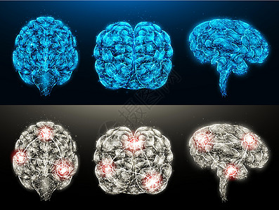 脑炎健康大脑和有炎症病灶的患病大脑的多边形矢量插图集 神经系统医学横幅 模板或背景插画