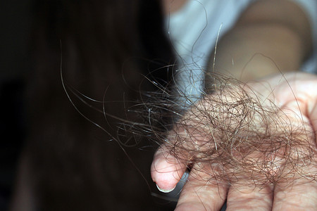 女孩手上握着一堆掉下来的头发 手拉紧 毛发有问题背景图片