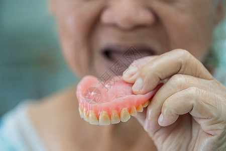 亚洲老年或老年老年妇女患者在护理医院病房坚持使用假牙 健康强健的医疗理念游泳保健快乐退休女孩享受女性牙科水池背景图片