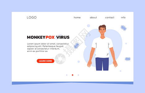 疖肿猴痘病毒症状登陆页面 猴痘病毒的网站模板 猴痘的症状 患有猴痘病毒的人设计图片