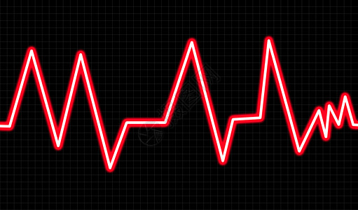 心电图检测带波形网格海浪心脏黑色频率心电正方形监视器网格状心电图图形化背景