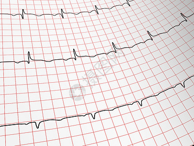 心脏病专家心电组脉动专家医院保健医疗药品测试医学心脏病服务背景