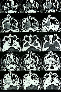 大脑的磁共振技术骨骼诊断收音机电影x射线放射科脖子谐振解剖学人们高清图片素材