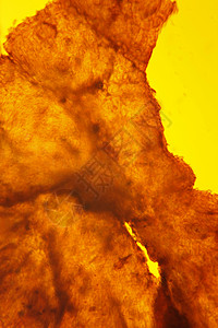 皮肤沙卡照片科学卵泡吞噬细胞细菌显微镜显微插头背景图片