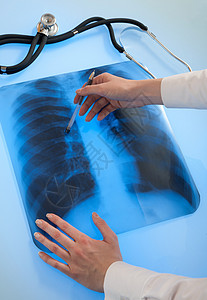 肺功能检查肺部X光照片诊断胸部手术外科辐射医师医院卫生考试诊所背景