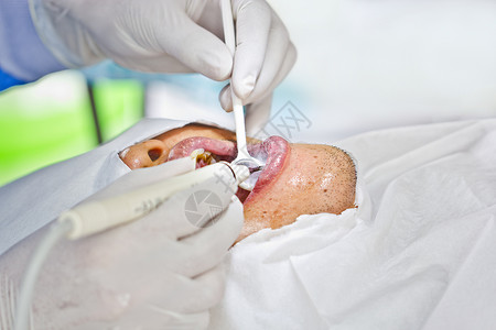 预防牙科工具牙齿诊所医生空腔药品口腔科工作病人矫正背景图片