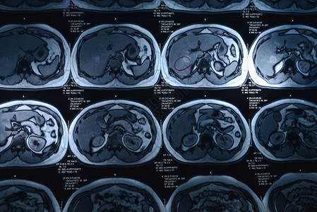 x射线电脑保健医疗药品疾病水平摄影医学扫描图像背景图片