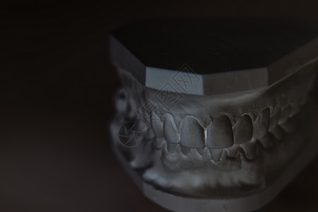 伤寒杂病论白色背景上的人类下巴的Gypsum模型投掷技术口服植入物桥梁保健药品牙医教育牙齿背景