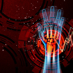 手掌疼痛科学插图骨骼痛风痛苦风湿病生物学手指方阵医疗背景图片