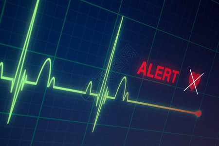 心跳GIF显示器上的心脏比心动图要强蓝色逮捕警报攻击死亡失败电脑速度健康脉冲背景