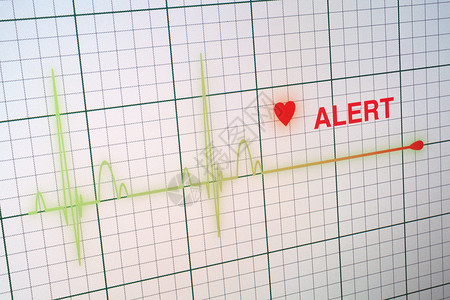 心跳显示器上的心脏比心动图要强失败屏幕警报速度蓝色脉冲攻击技术逮捕电脑背景